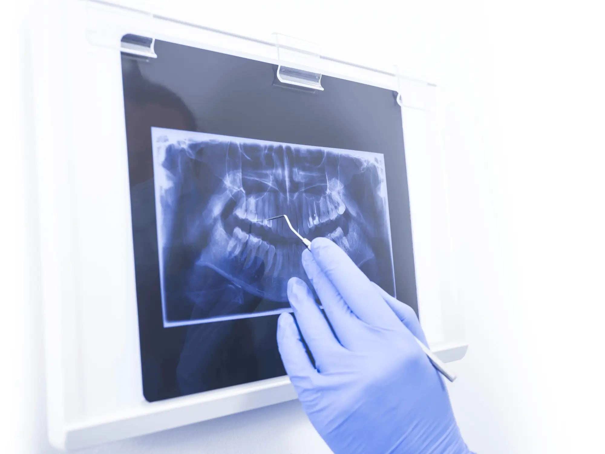 Imagistică Dentară (3)